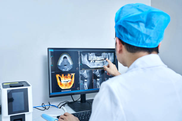 Best Emergency Wisdom Teeth Removal in Berthoud, CO